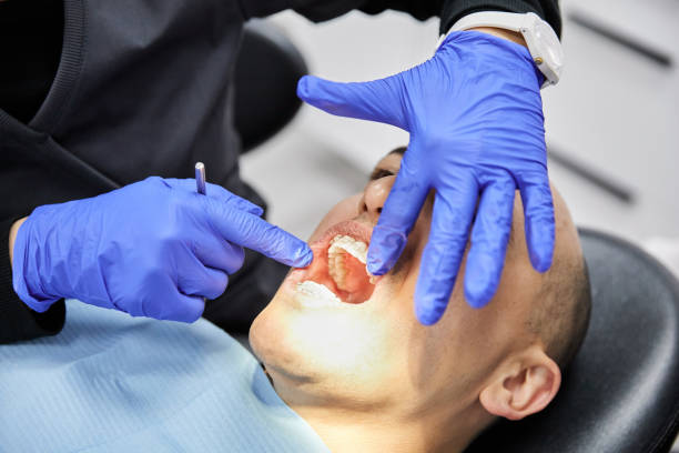 Best Emergency Treatment for Dental Infections or Abscesses in Elma Center, NY