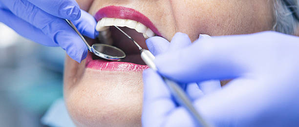 Best Urgent Care for Lost Fillings or Crowns in Elma Center, NY